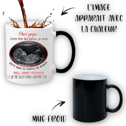 Mug échographie fête des pères - Personnalisable - Cadeau original - Céramique 330mL - Nail Gallerys