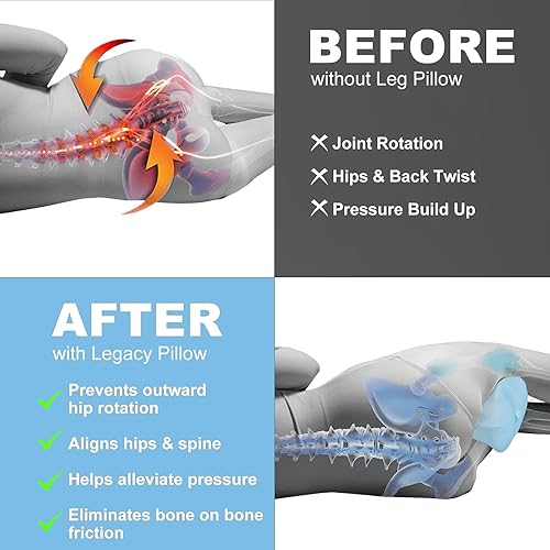 Hydomi Coussin de soutien de jambe pour les personnes dormant sur le côté, soulage le dos, les hanches, la sciatique, les douleurs articulaires : mémoire de forme - Nail Gallerys