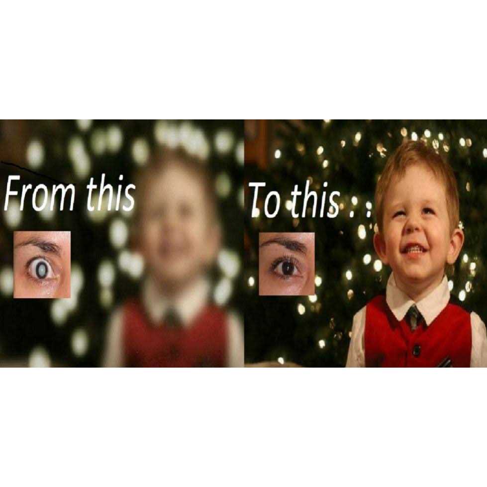 Cataract Eye Drops 4% NAC. Strongest anywhere.Proven on People & Pets. 2 x 10ml - Nail Gallerys