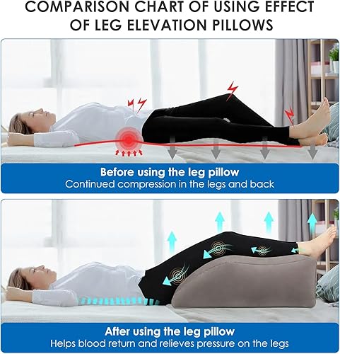 CECOMBINE Coussin veineux - Coussin de surélévation des Jambes - Gonflable - Confortable - pour Dormir - Confort - Améliore la Circulation Sanguine et réduit Les gonflements - Nail Gallerys